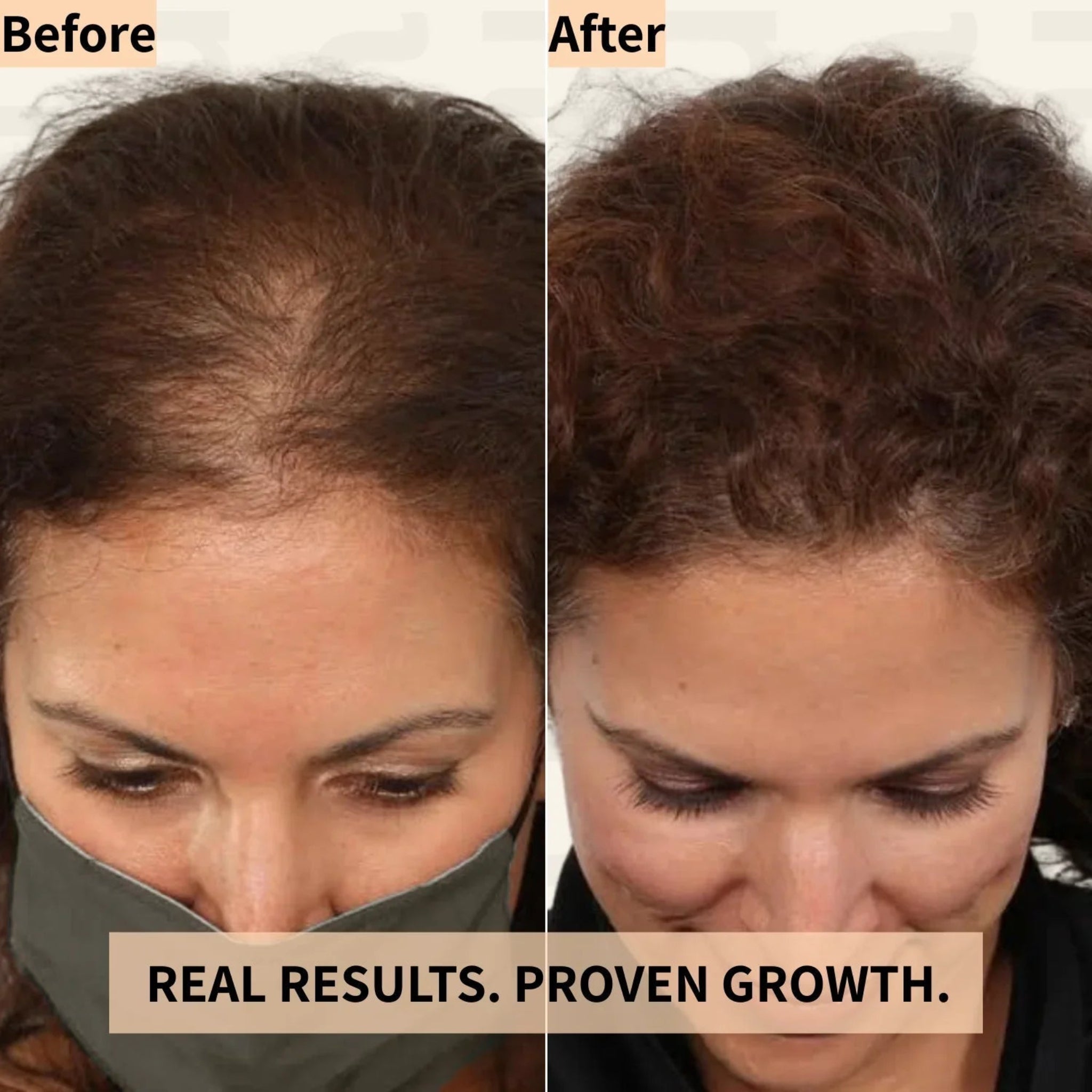 Before and after comparison of hair growth with text 'Real results. Proven growth.'